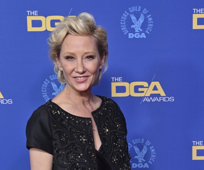 Anne Heche intubated, but in stable condition after fiery car crash