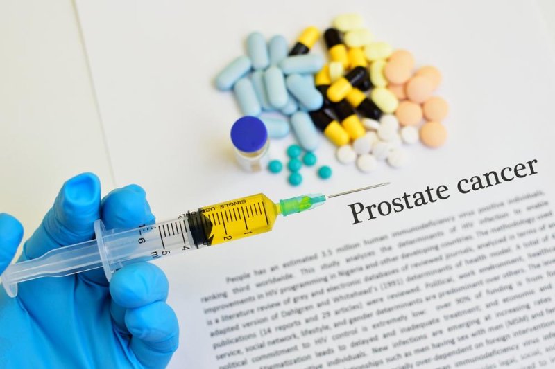 An injectible cholesterol drug stopped the growth of prostate cancer cells in the lab and in mice, according to researchers at the University of Missouri. Photo by Jarun Ontakrai/Shutterstock