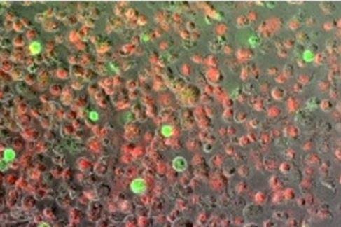 Scientists at Binghamton University in New York had more success killing cancer cells in the pancreas through heating and freezing, a process known as dual thermal ablation, rather than heating or freezing alone. In the image, live cells are in green and dead cells are in red. Photo courtesy of Binghamton University