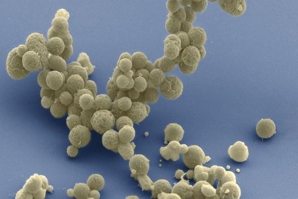 A close-up image reveals newly synthesized bacterial cells. The cells, which belong to a human-engineered species called JCVI-syn.30, boast the shortest genome in the world. Photo by JCVI