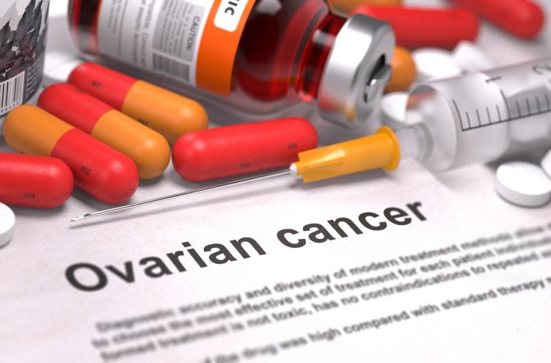 Ovarian cancer often comes back, generally more aggressive and less respondent to chemotherapy. Photo by Tashatuvango/Shutterstock