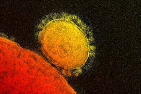 Microscopic view of MERS coronavirus (U.S. National Institutes of Health)