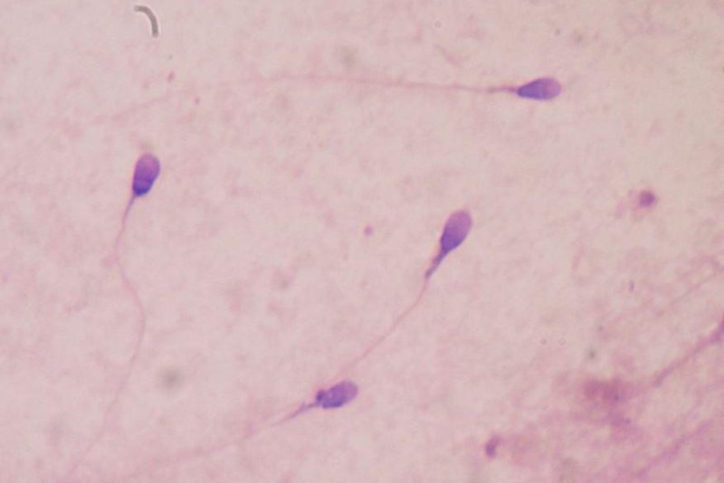 Researchers have found a newly discovered sperm structure may contribute to infertility, miscarriages and birth defects, and could lead to new diagnostics and therapeutic methods. Photo by Bobjgalindo/Wikimedia Commons