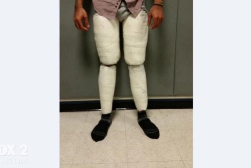 U.S. Customs and Border Protection officers at New York's John F. Kennedy International Airport said they found 10 pounds of cocaine strapped to the legs of a traveler arriving from the Dominican Republic. Screenshot: KTVI-TV
