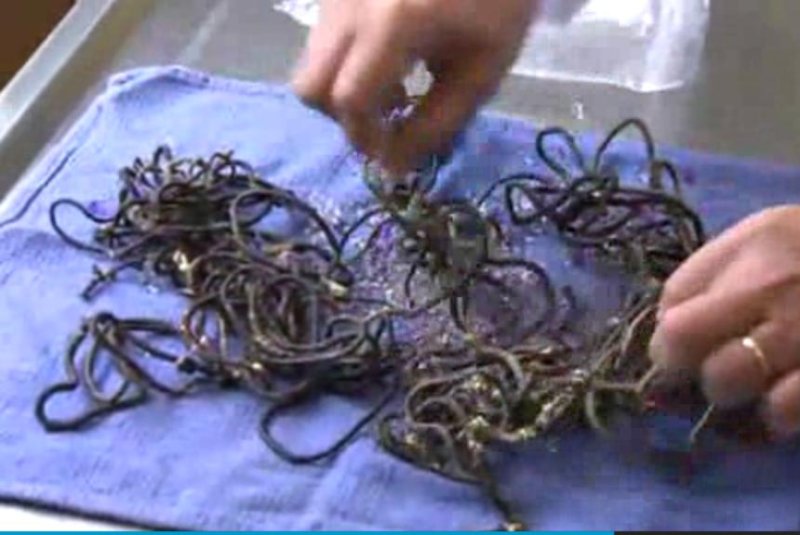 62 hair bands, eight pairs of undies removed from dog's stomach