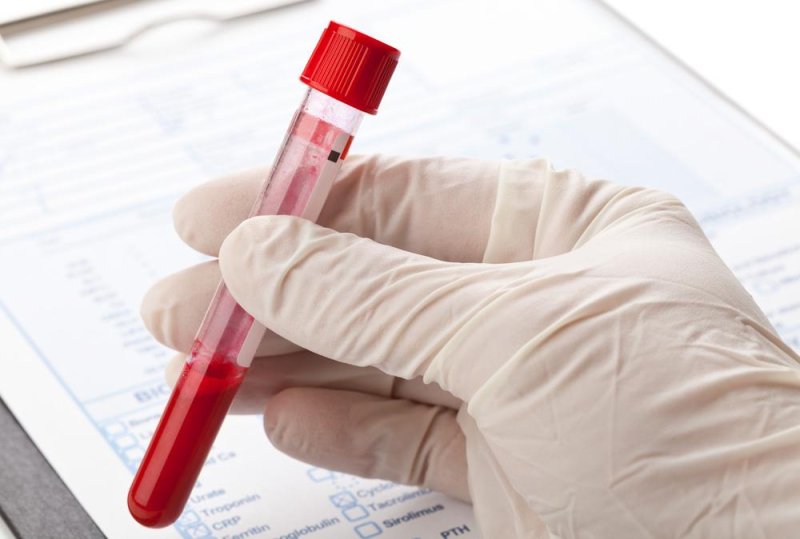 While blood tests can be used to detect some cancers, the FDA said a San Diego company has no proof its blood test works in patients who have not already been diagnosed with some form of the disease. Photo by Shawn Hempel/Shutterstock