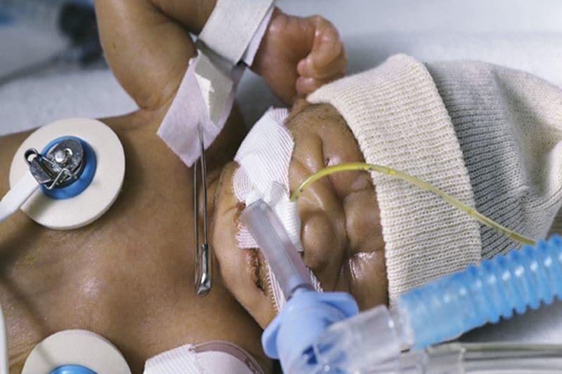 Minority infants receive poorer care in NICUs, study finds