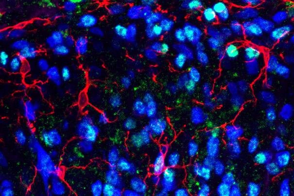 When researchers blocked FKBP51 proteins, light blue in mouse spinal cord tissue above, pain was alleviated in the mice. Photo by Dr. Sandrine Géranton/University College London