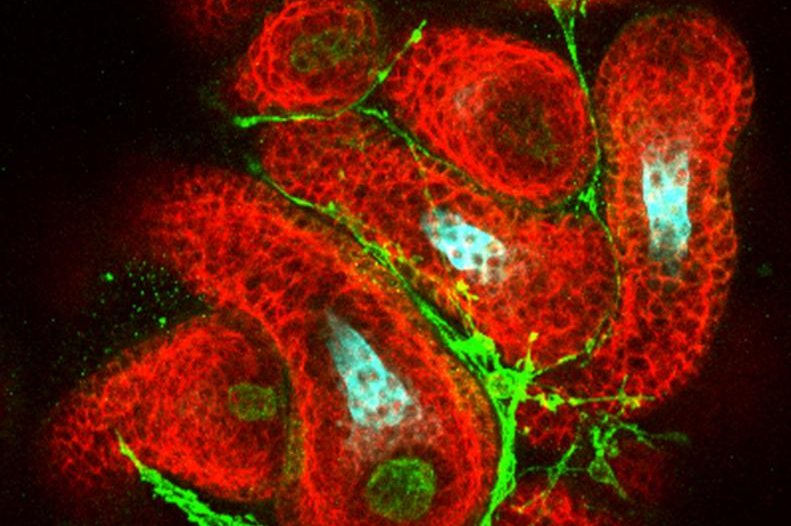 Hair follicles can be generated from mouse pluripotent stem cells in a 3D cell culture system. The hair follicles, in red, grow radially out of spherical skin organoids and contain follicle-initiating dermal papilla cells, in green, and hair shafts, in cyan. Photo by Jiyoon Lee and Karl R. Koehler/Indiana University School of Medicine