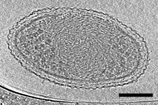 Microscope image of the newly detailed ultra-small bacterial cell. Photo by Berkeley Lab