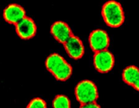 Study: Common antibiotic kills drug-resistant bacteria