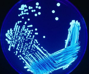 Legionella colonies growing on a plate, courtesy of the Centers for Disease Control and Prevention.