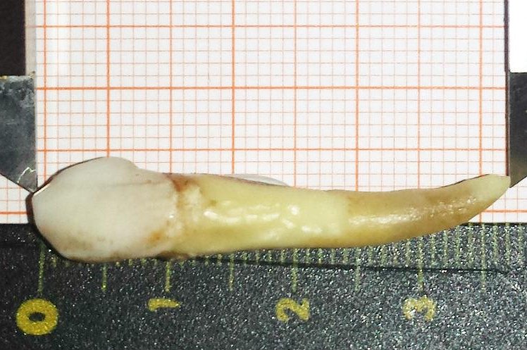 A German dentist received a Guinness World Records certificate this week after pulling a 1.46-inch tooth from the mouth of a patient. Photo courtesy of Guinness World Records
