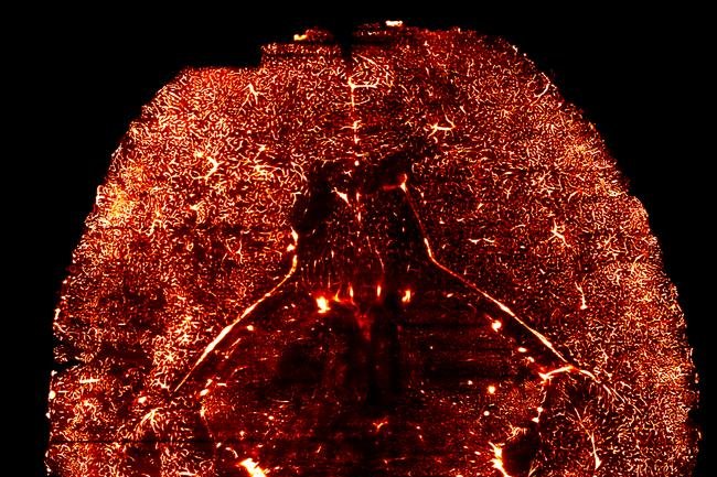 Blood vessels control brain growth, scientists say