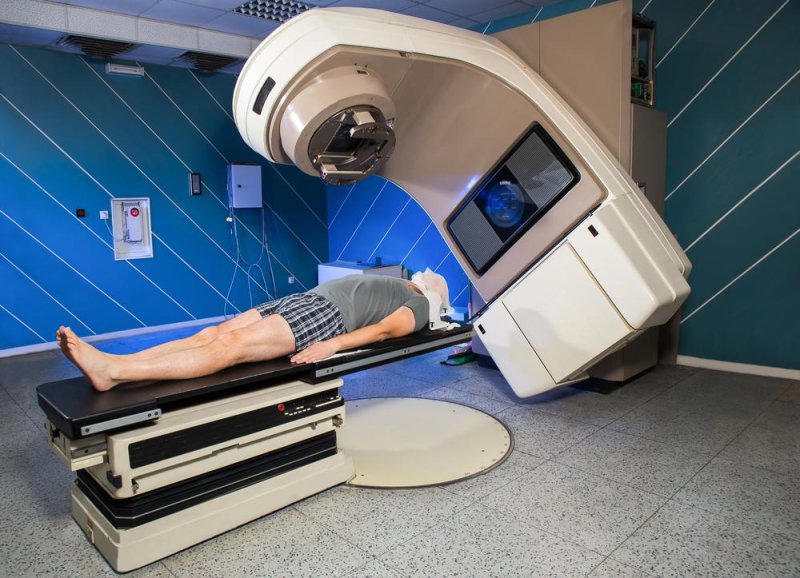 Late-stage cancer often over-treated with radiation