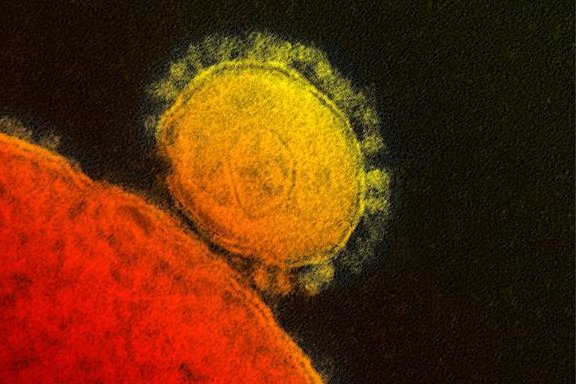 Two Florida hospital healthcare workers who treated the MERS patient have respiratory symptoms. Pictured is the MERS coronavirus. (National Institutes of Health)