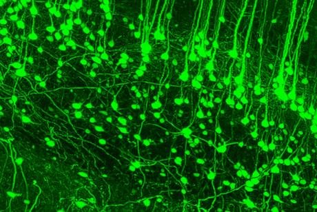 A new imaging technique has enabled scientists to see neuronal structures of the cortex in unprecedented detail. Photo by LMU