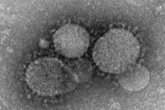 MERS-CoV particles as seen by negative stain electron microscopy. Virions contain characteristic club-like projections emanating from the viral membrane. (CC/Centers for Disease Control/Maureen Metcalfe/Cynthia Goldsmith/Azaibi Tamin)