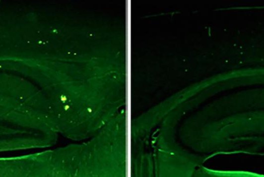 In mice with Alzheimer's disease, researchers showed raising levels of neuregulin-1, pictured at right, lowers a marker of disease pathology in a part of the brain that controls memory, compared to mice in an untreated control group, pictured on the left. Photo by the Salk Institute