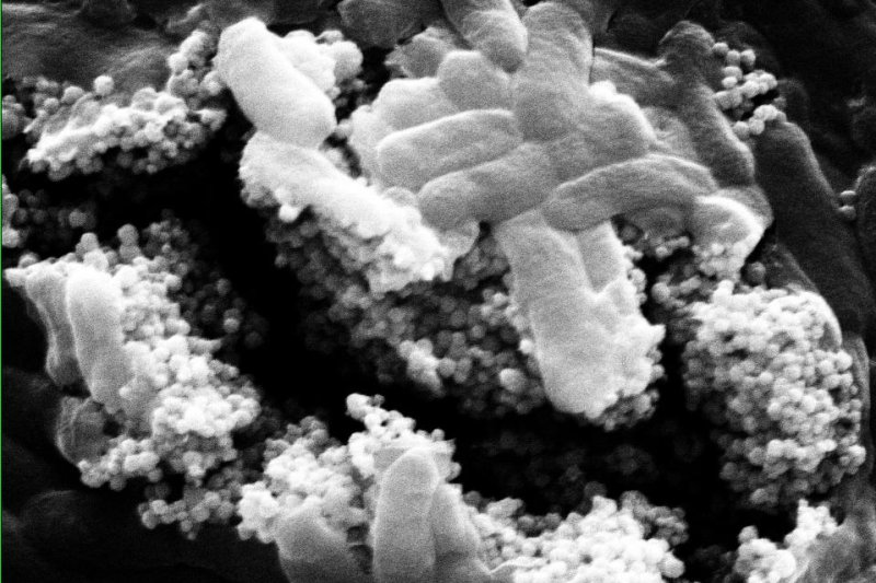A closeup image shows nanoparticle clusters, with phage viruses attached, seeking out and killing <em>Escherichia coli</em> bacteria. Photo by Alvarez Group/Rice University