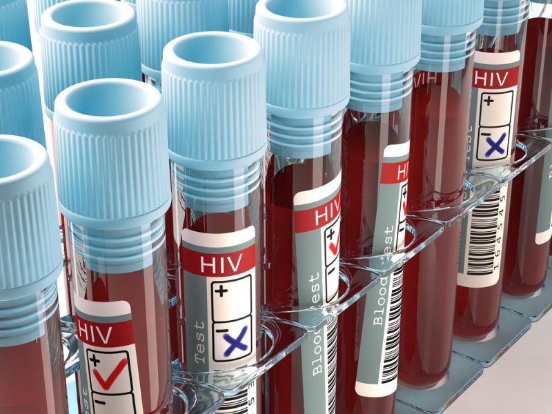 The antibody VRC01, discovered in the blood of an HIV-positive person in 2010, prevents 90 percent of the world's HIV strains from infecting cells and may help lead to a vaccine against the virus. Photo by ktsdesign/Shutterstock