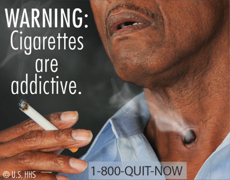 This FDA image released on June 21, 2011 shows one of the new proposed cigarette warning labels. Beginning September 2012, FDA will require larger, more prominent cigarette health warnings on all cigarette packaging and advertisements in the United States. These warnings mark the first change in cigarette warnings in more than 25 years and are a significant advancement in communicating the dangers of smoking. UPI/FDA