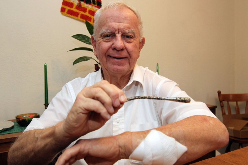 Arthur Lampitt displays the turning signal lever in Granite City, Illinois on January 2, 2015, that was removed from his arm during a proceedure on December 31, 2014. In 1963, the 24-year-old Lampitt was driving his Ford Thunderbird when he was involved in an accident, in East Peoria, Illinois, breaking five ribs and his hip was severely broken in several places. Because all of the blood, assumed to be from glass, doctors failed to notice a metal rod Ð the T-bird's turn signal arm. In December 2014, Lampitt noticed a protrusion in his arm and was also feeling some pain. On December 31, 2014, a specialist removed the seven-inch rod from his arm in a 45 minute procedure. Photo by Bill Greenblatt/UPI