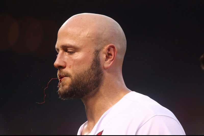 St. Louis Cardinals' Matt Holliday takes fastball to face
