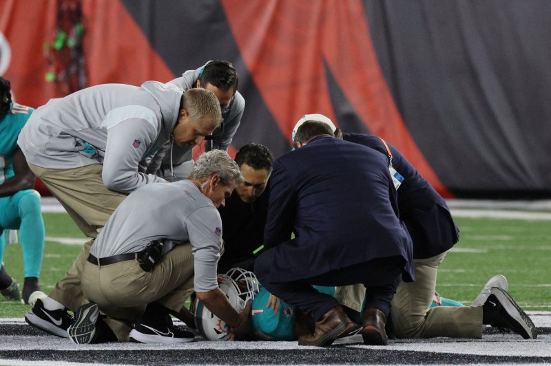 The NFL said 149 reported concussions were sustained by players during the 2022-23 regular-season. File Photo by John Sommers II/UPI