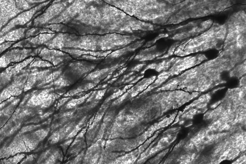 Neurons, or brain cells, that become stressed or senescent with aging could be a treatment target for Alzheimer's disease, according to a new study. Photo by MethoxyRoxy/Wikimedia Commons