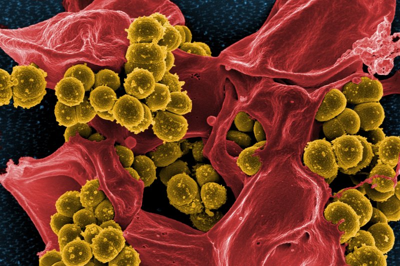 Scanning electron micrograph of methicillin-resistant Staphylococcus aureus or MRSA. Researchers in Denmark have developed a method to quickly identify antibiotic-resistant gut microbes to better treat antibiotic resistance. (Flickr/NIAID)
