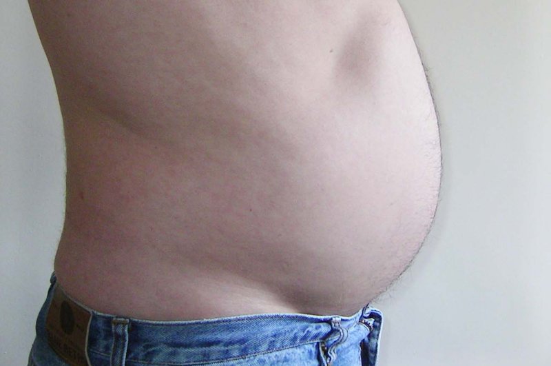 Study: Big belly bad for your heart even if not obese