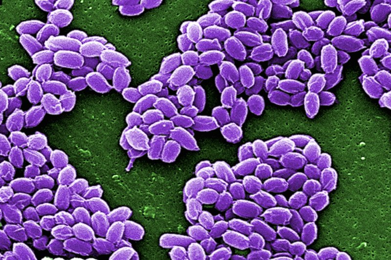 Department of Defense mistakenly ships live anthrax to labs across country