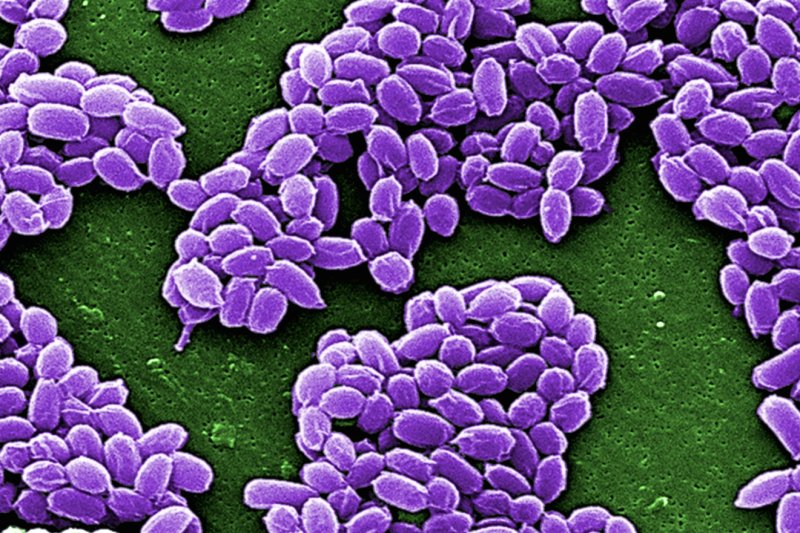 Pentagon: inadequate killing, testing caused largest anthrax breach in history