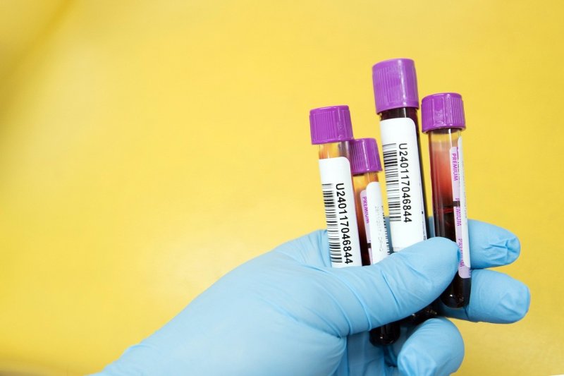 Researchers think they've found a way to make the blood test for prostate-specific antigen (PSA) accurate enough to significantly reduce overdiagnosis and better predict dangerous cancers. Photo AhmadArdity/Pixabay